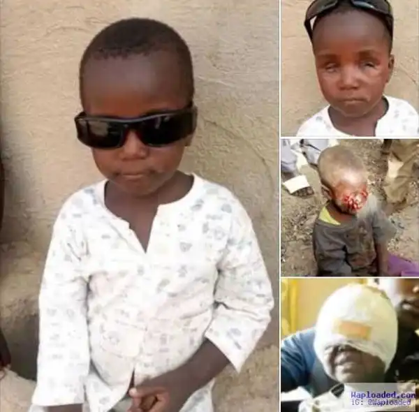 Tragic new photo of 4year old Kaduna boy whose eyes were plucked by ritualists